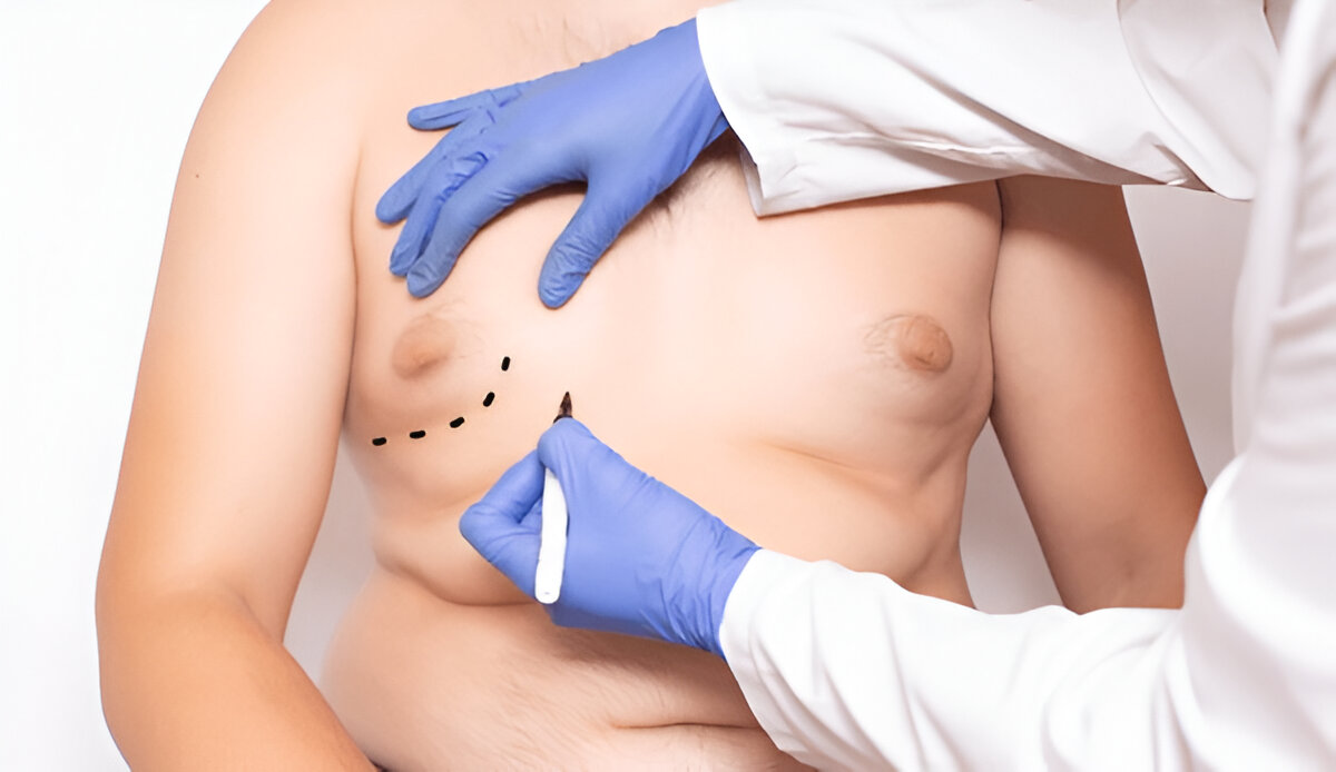 Why is my left breast bigger than the right in males?