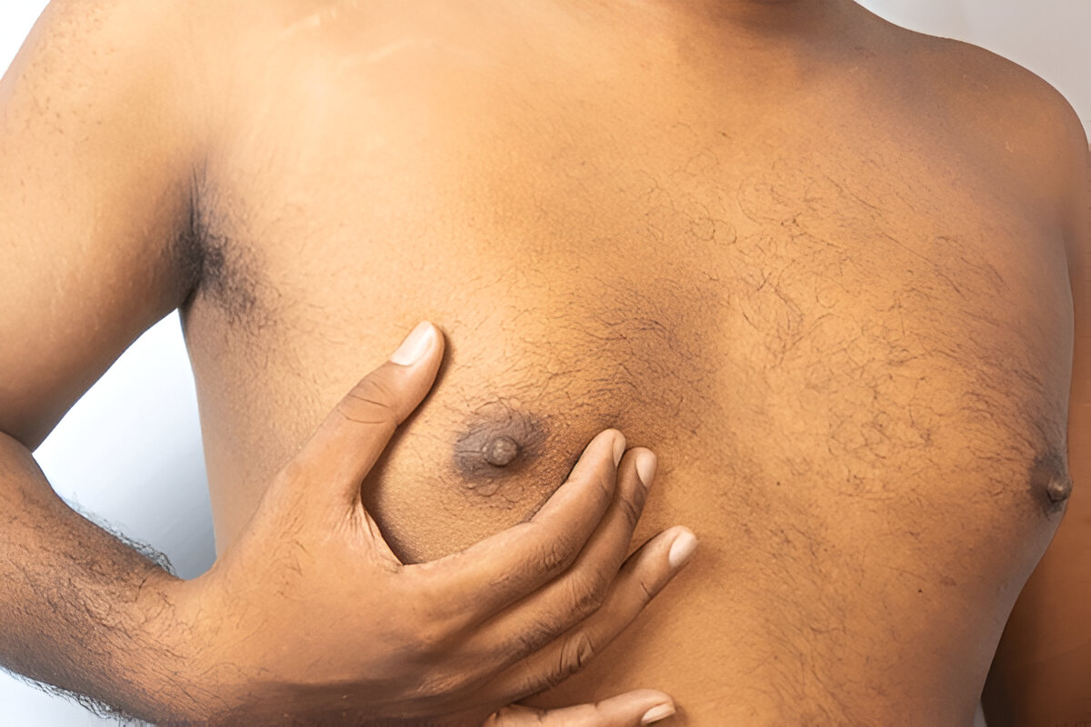 gynecomastia pain